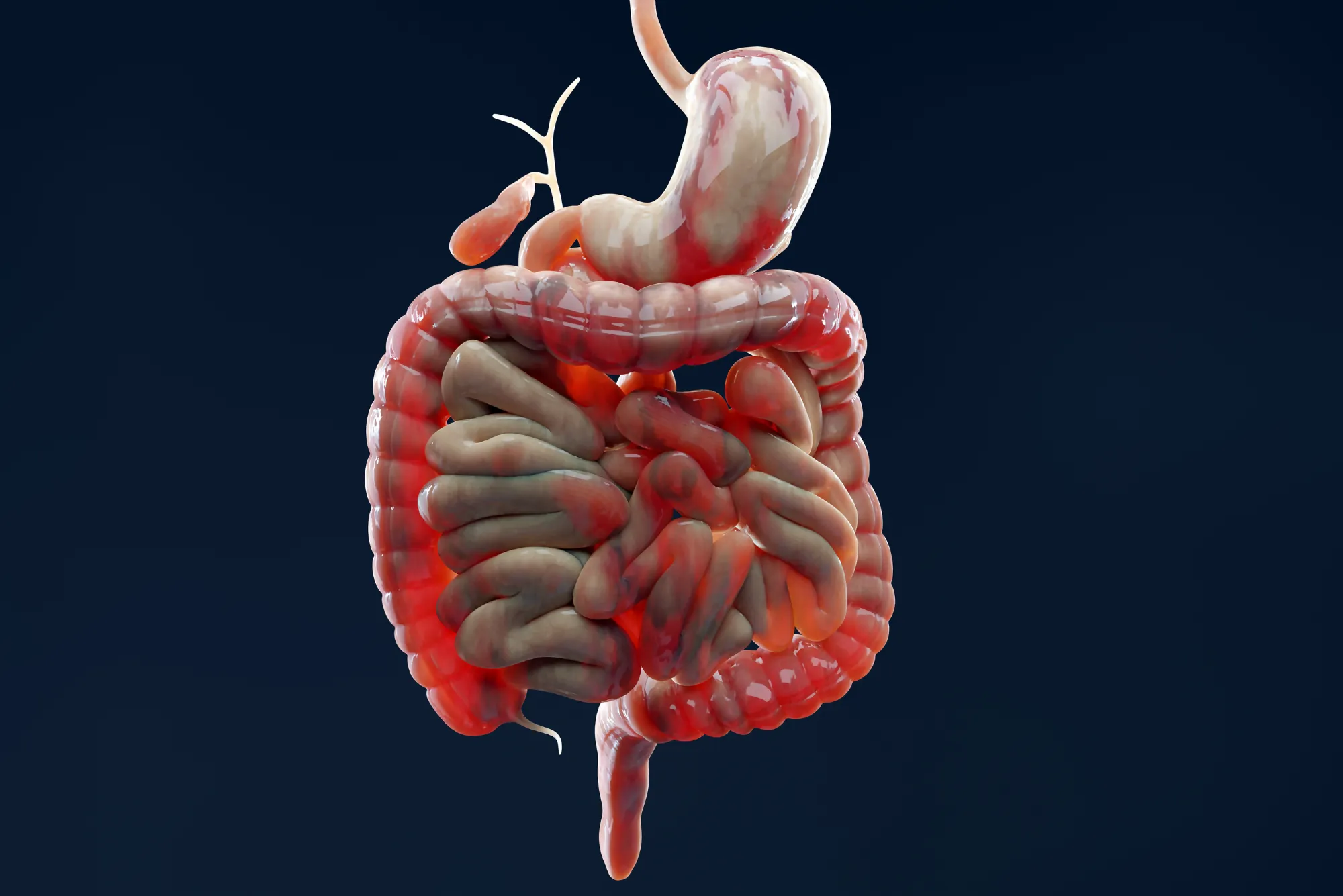 Digestive Health Understanding Common Disorders